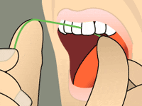 Holding the floss tightly, gently saw it between your teeth. Then curve the floss into a C-shape against one tooth and gently slide it beneath your gums.