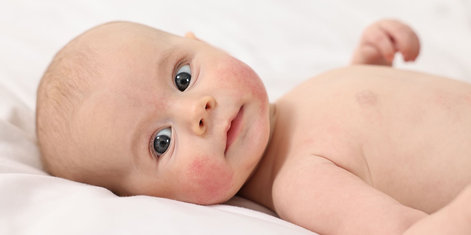 Why Are My Baby’s Cheeks Red? Common Causes and When to Seek Care
